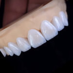 local cosmetic dentist