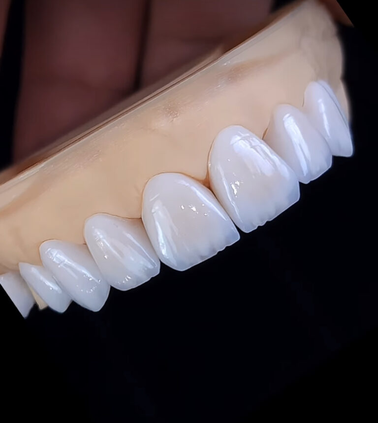 local cosmetic dentist