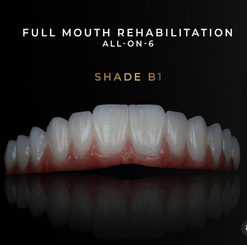 Affordable Cosmetic Dentistry Near You